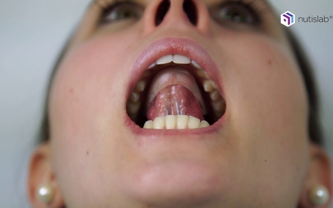 Protocole TONG-E adulte