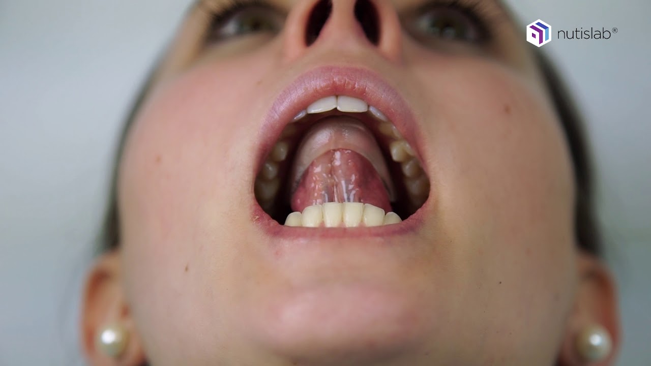 protocole tong-e portée par une patiente