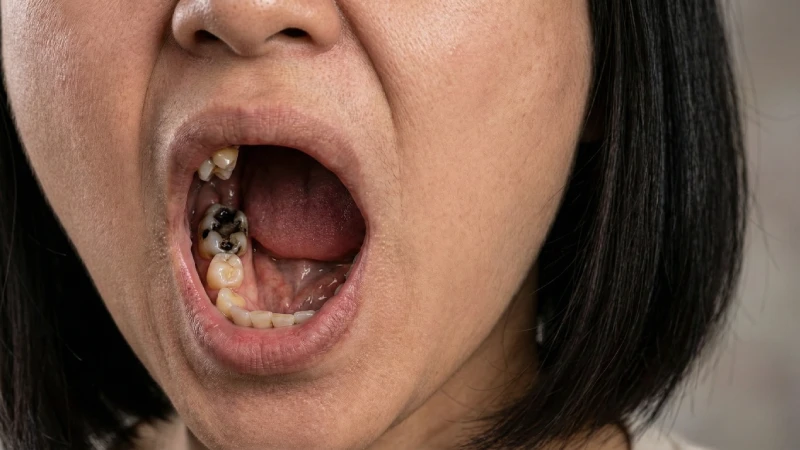 Couronne dentaire à Paris : types, conseils et prix