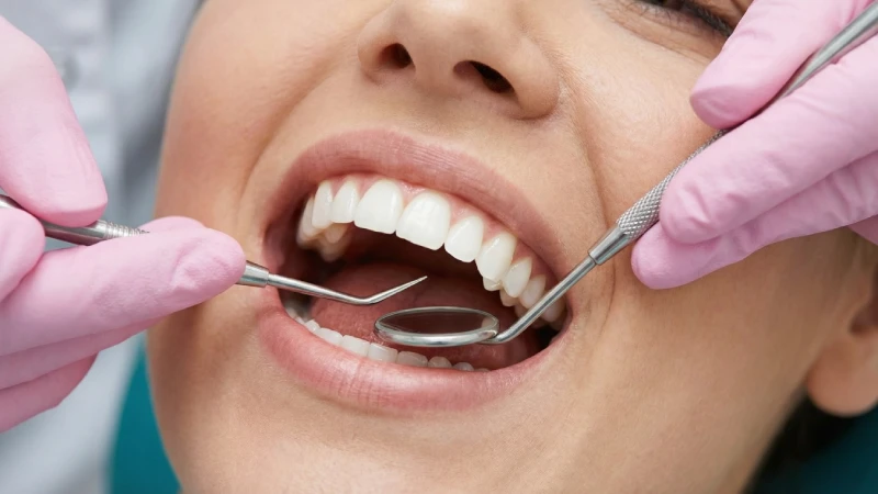 Détartrage à Paris : tout savoir sur ce soin essentiel