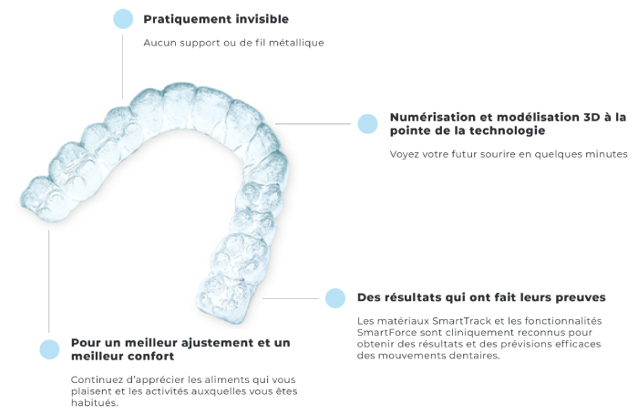 Schema gouttiere invisible paris