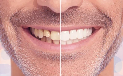 Cas traités AVANT/APRES