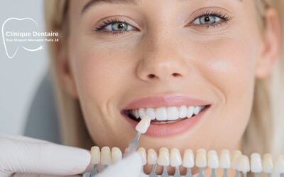 Les facettes dentaires : l&rsquo;excellence esthétique pour un sourire parfait
