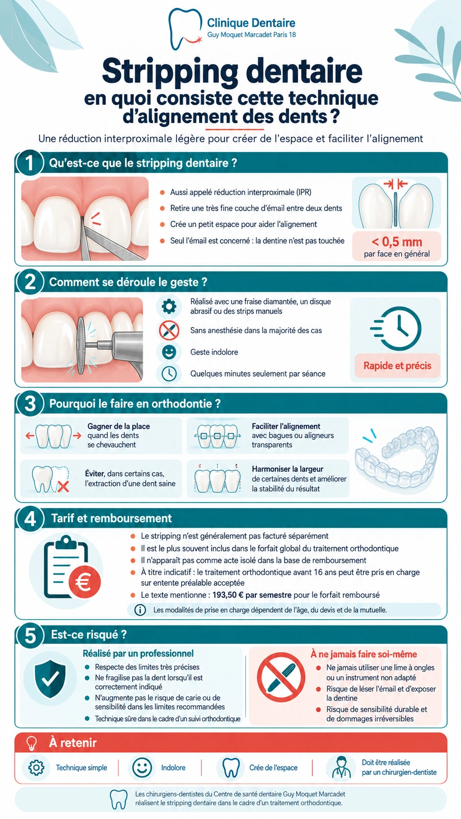 Guide du stripping dentaire